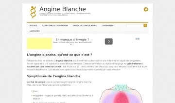 angine blanche