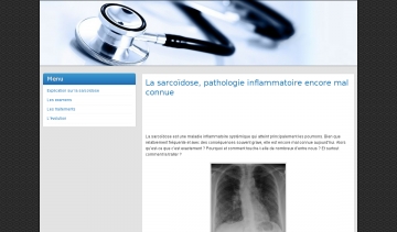 site sarcoidose.fr