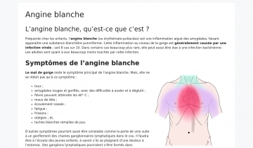 Angine Blanche : mieux comprendre l’inflammation aiguë des amygdales