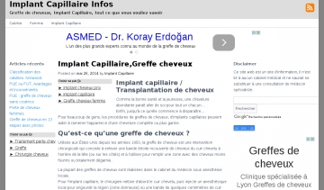 Informations sur la greffe de cheveux