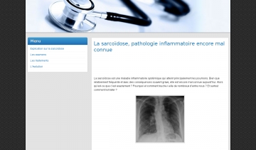 site sarcoidose.fr