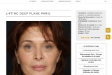 Lifting Deep Plane